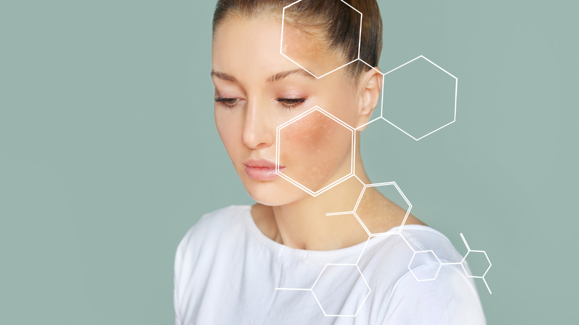 tip-image-Arbutyna - naturalny składnik kosmetyków o właściwościach rozjaśniających